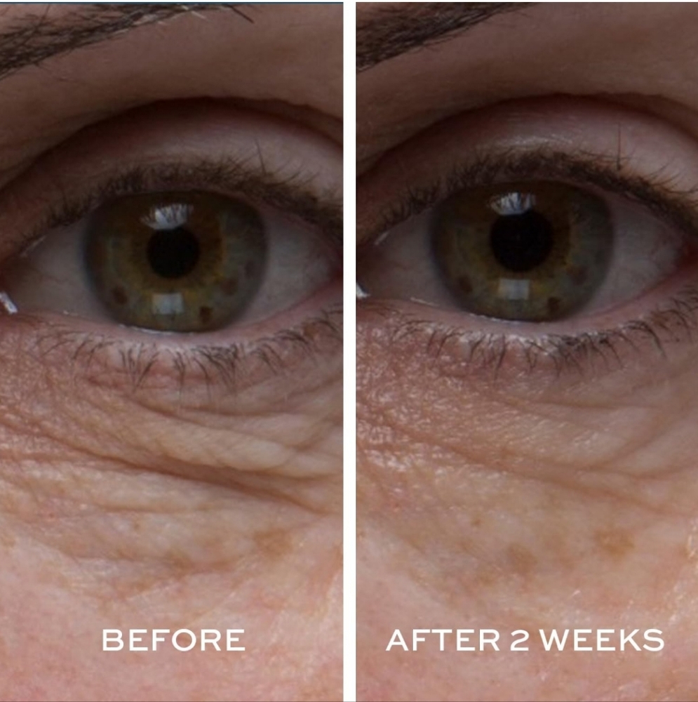 Elemis Peptide4 Eye Recovery Cream, NIB - Picture 3 of 4